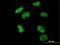 Zinc Finger Protein 502 antibody, H00091392-B01P, Novus Biologicals, Immunocytochemistry image 