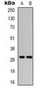 Regulating Synaptic Membrane Exocytosis 4 antibody, orb318885, Biorbyt, Western Blot image 