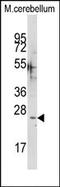 S100 Calcium Binding Protein G antibody, AP14245PU-N, Origene, Western Blot image 
