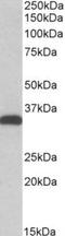 Carbonyl Reductase 3 antibody, TA311203, Origene, Western Blot image 