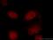 Histone-lysine N-methyltransferase SETD2 antibody, 55377-1-AP, Proteintech Group, Immunofluorescence image 