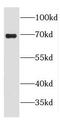 Peroxisomal carnitine O-octanoyltransferase antibody, FNab01993, FineTest, Western Blot image 