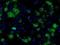 Fumarylacetoacetate Hydrolase Domain Containing 2A antibody, NBP2-02331, Novus Biologicals, Immunofluorescence image 
