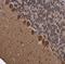 BCAR1 Scaffold Protein, Cas Family Member antibody, GTX133337, GeneTex, Immunohistochemistry paraffin image 