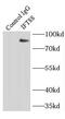 Intraflagellar Transport 88 antibody, FNab04165, FineTest, Immunoprecipitation image 