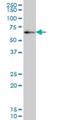 Zinc Finger Protein 207 antibody, H00007756-M01, Novus Biologicals, Western Blot image 