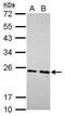 Mitochondrial Ribosomal Protein S23 antibody, PA5-31326, Invitrogen Antibodies, Western Blot image 