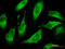 Phosphatidate cytidylyltransferase 1 antibody, LS-B15603, Lifespan Biosciences, Immunofluorescence image 