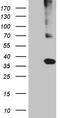 Major Histocompatibility Complex, Class II, DR Beta 5 antibody, TA812174S, Origene, Western Blot image 