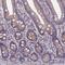 5',3'-Nucleotidase, Mitochondrial antibody, NBP1-92203, Novus Biologicals, Immunohistochemistry paraffin image 