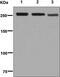 FAS antibody, ab128870, Abcam, Western Blot image 