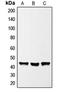 Potassium Calcium-Activated Channel Subfamily N Member 3 antibody, orb340998, Biorbyt, Western Blot image 