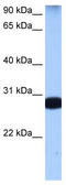 Staufen Double-Stranded RNA Binding Protein 1 antibody, TA345890, Origene, Western Blot image 