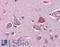 SIM BHLH Transcription Factor 1 antibody, LS-B3087, Lifespan Biosciences, Immunohistochemistry paraffin image 