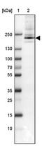ADP Ribosylation Factor Guanine Nucleotide Exchange Factor 1 antibody, PA5-54894, Invitrogen Antibodies, Western Blot image 