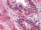 TP antibody, M06114, Boster Biological Technology, Immunohistochemistry frozen image 