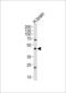 Abhydrolase Domain Containing 12 antibody, 63-694, ProSci, Western Blot image 
