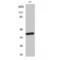 Melatonin Receptor 1B antibody, LS-C384510, Lifespan Biosciences, Western Blot image 