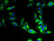 Major Facilitator Superfamily Domain Containing 5 antibody, A59798-100, Epigentek, Immunofluorescence image 