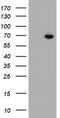 IlvB Acetolactate Synthase Like antibody, TA503141, Origene, Western Blot image 