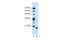 Peptidyl-TRNA Hydrolase 2 antibody, 31-347, ProSci, Western Blot image 