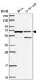 Chromosome 19 Open Reading Frame 44 antibody, NBP2-58435, Novus Biologicals, Western Blot image 