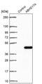Abhydrolase Domain Containing 17A antibody, PA5-60304, Invitrogen Antibodies, Western Blot image 