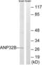 Acidic Nuclear Phosphoprotein 32 Family Member B antibody, LS-C119687, Lifespan Biosciences, Western Blot image 