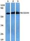 Solute Carrier Family 22 Member 1 antibody, PA5-75775, Invitrogen Antibodies, Western Blot image 