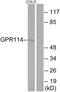 Adhesion G Protein-Coupled Receptor G5 antibody, A30799, Boster Biological Technology, Western Blot image 