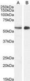 Serine/Threonine Kinase 35 antibody, GTX89642, GeneTex, Western Blot image 