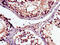 Serine/threonine-protein kinase MAK antibody, CSB-PA013369LA01HU, Cusabio, Immunohistochemistry paraffin image 