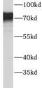 Acyl-CoA Synthetase Short Chain Family Member 1 antibody, FNab00113, FineTest, Western Blot image 