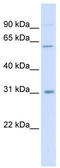 Carbohydrate Sulfotransferase 2 antibody, TA339404, Origene, Western Blot image 