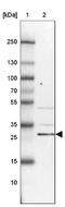 KIAA1257 antibody, NBP2-14154, Novus Biologicals, Western Blot image 