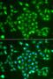 Ubiquitin C-Terminal Hydrolase L5 antibody, GTX55834, GeneTex, Immunocytochemistry image 