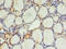 EF-Hand Calcium Binding Domain 14 antibody, A58898-100, Epigentek, Immunohistochemistry paraffin image 