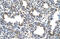 Butyrylcholinesterase antibody, ARP44208_T100, Aviva Systems Biology, Immunohistochemistry paraffin image 
