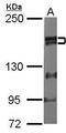 Zinc Finger MYM-Type Containing 2 antibody, GTX105550, GeneTex, Western Blot image 