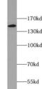 FLT4 antibody, FNab09394, FineTest, Western Blot image 