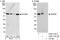 NOP58 Ribonucleoprotein antibody, A302-719A, Bethyl Labs, Immunoprecipitation image 