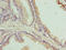Chromosome 17 Open Reading Frame 64 antibody, LS-C398763, Lifespan Biosciences, Immunohistochemistry paraffin image 