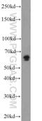 Peroxisomal Biogenesis Factor 5 Like antibody, 13084-1-AP, Proteintech Group, Western Blot image 