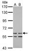 Zinc Finger Protein 419 antibody, LS-C155699, Lifespan Biosciences, Western Blot image 