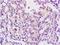 N-acylglucosamine 2-epimerase antibody, orb10064, Biorbyt, Immunohistochemistry paraffin image 