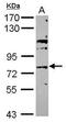 ATP Binding Cassette Subfamily G Member 4 antibody, GTX116746, GeneTex, Western Blot image 