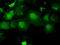 Adenylate kinase isoenzyme 1 antibody, TA500322, Origene, Immunofluorescence image 