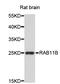 RAB11B, Member RAS Oncogene Family antibody, STJ26432, St John