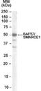 SWI/SNF Related, Matrix Associated, Actin Dependent Regulator Of Chromatin, Subfamily E, Member 1 antibody, NB100-1297, Novus Biologicals, Western Blot image 