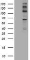 ALK Receptor Tyrosine Kinase antibody, TA801308S, Origene, Western Blot image 
